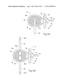 SYSTEMS AND METHODS FOR TREATING VERTEBRAL BODIES diagram and image