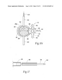 SYSTEMS AND METHODS FOR TREATING VERTEBRAL BODIES diagram and image
