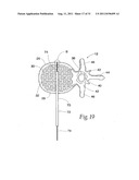 SYSTEMS AND METHODS FOR TREATING VERTEBRAL BODIES diagram and image