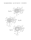 SYSTEMS AND METHODS FOR TREATING VERTEBRAL BODIES diagram and image