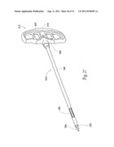 SYSTEMS AND METHODS FOR TREATING VERTEBRAL BODIES diagram and image