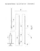 SYSTEMS AND METHODS FOR TREATING VERTEBRAL BODIES diagram and image