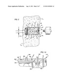 INTERBODY SPINAL IMPLANT INDUCTIVELY COUPLED TO AN EXTERNAL POWER SUPPLY diagram and image