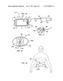 INTERBODY SPINAL IMPLANT INDUCTIVELY COUPLED TO AN EXTERNAL POWER SUPPLY diagram and image