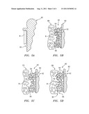 Methods of Using Water-Soluble Inorganic Compounds for Implants diagram and image