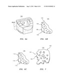 Methods of Using Water-Soluble Inorganic Compounds for Implants diagram and image