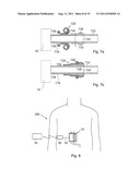 ARTIFICIAL STOMACH diagram and image