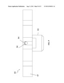 METHOD OF DONNING A PROSTHETIC LIMB diagram and image