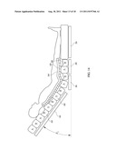 Method and Apparatus for Relieving Shear Induced by and Occupant Support diagram and image