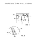 DEVICE AND METHOD FOR STORAGE TANK RESTRAINT ON A VEHICLE diagram and image