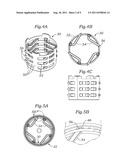 PROSTHETIC HEART VALVE PACKAGING SYSTEM diagram and image