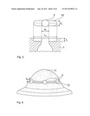 METHOD FOR BORING BOTTLE-LIKE HOLES HAVING A DEFINED GEOMETRY BY MEANS OF     PULSED LASER RADIATION diagram and image