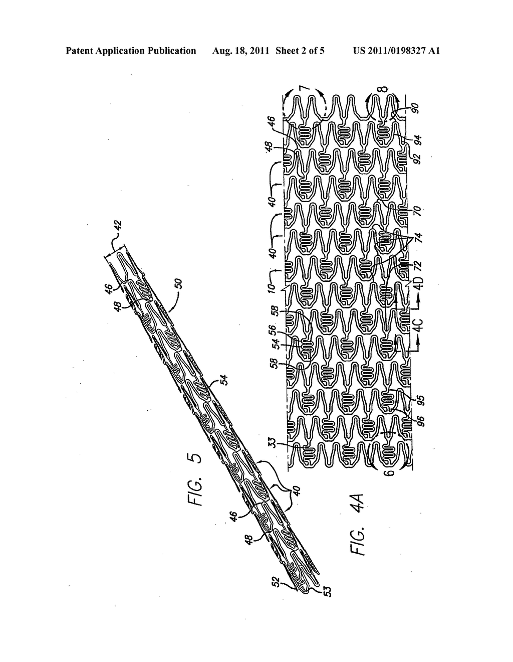 HYBRID STENT AND METHOD OF MAKING - diagram, schematic, and image 03