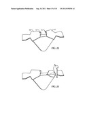 DISPOSABLE DUAL CHAMBER CONTAINER diagram and image