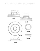 Wedge Post Base System diagram and image