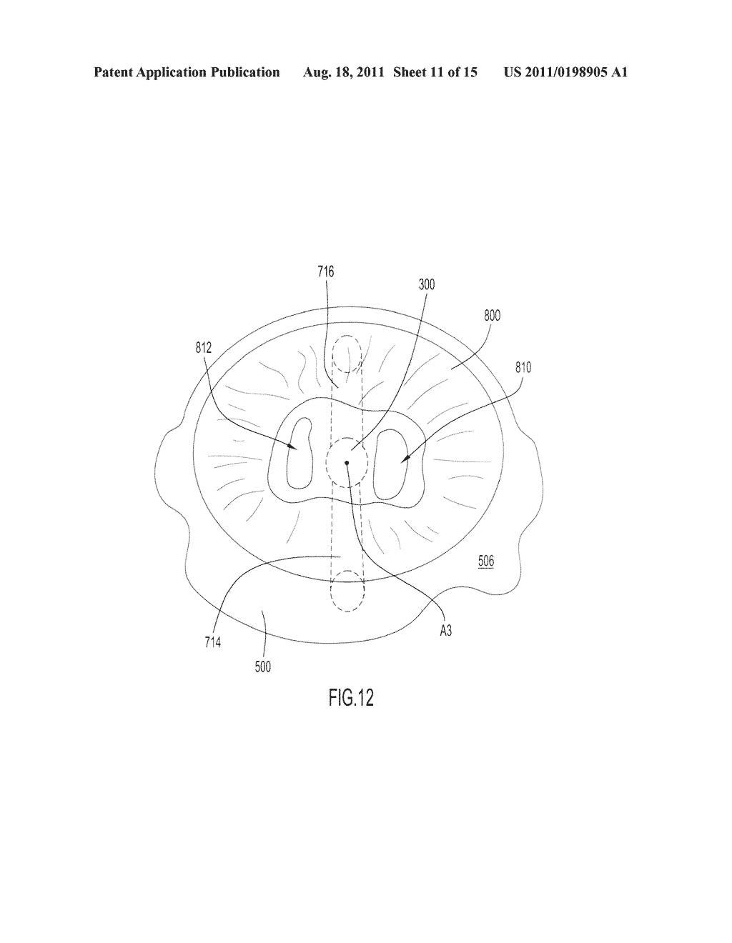 Infant Support Structure - diagram, schematic, and image 12