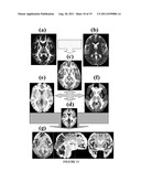 METHOD AND SYSTEM FOR DIFFUSION TENSOR IMAGING diagram and image