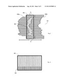 Radiotherapy and imaging apparatus diagram and image