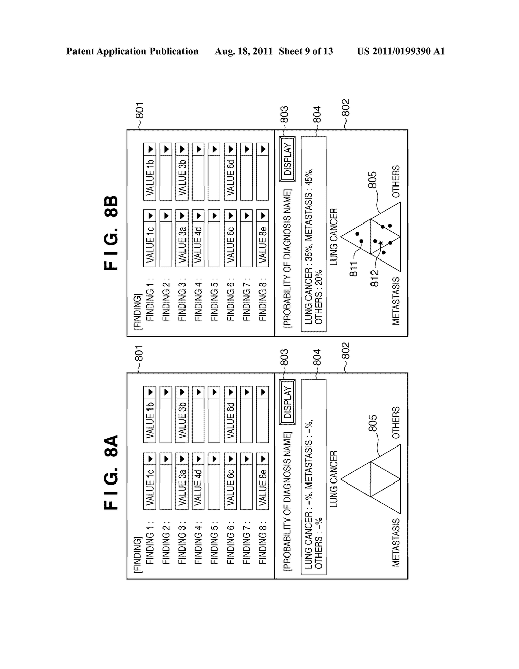 MEDICAL DIAGNOSIS SUPPORT APPARATUS, METHOD OF CONTROLLING MEDICAL     DIAGNOSIS SUPPORT APPARATUS, AND PROGRAM - diagram, schematic, and image 10