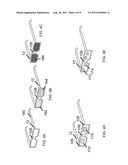 DETECTION AND DISPLAY OF STEREO IMAGES diagram and image