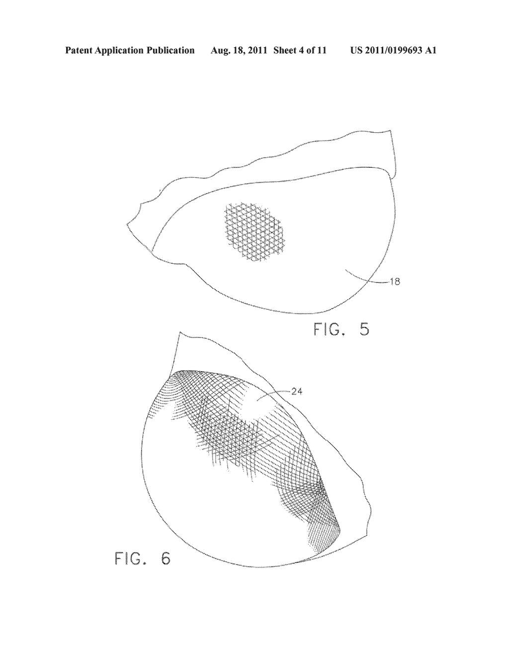 Method and Apparatus for Scaled Up Reproduction of Detailed Features - diagram, schematic, and image 05