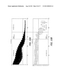 Methods and Systems for Detecting Temporally Oscillating Sources in Video     Signals Using a Recursive Infinite Impulse Response (IIR) Filter     Technique diagram and image