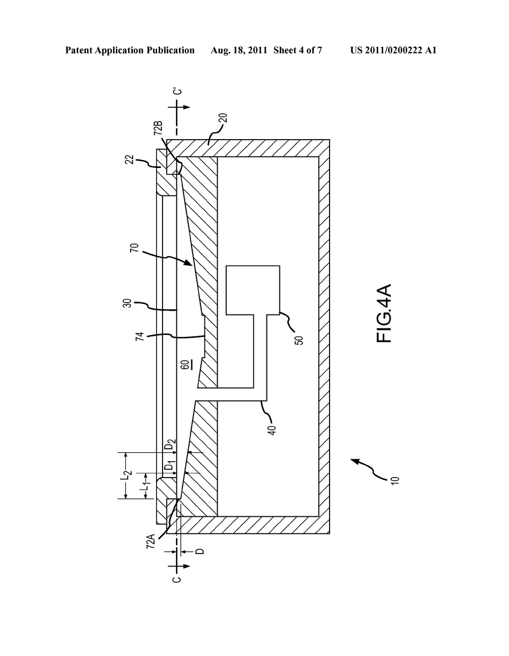 IMPLANTABLE MICROPHONE WITH SHAPED CHAMBER - diagram, schematic, and image 05