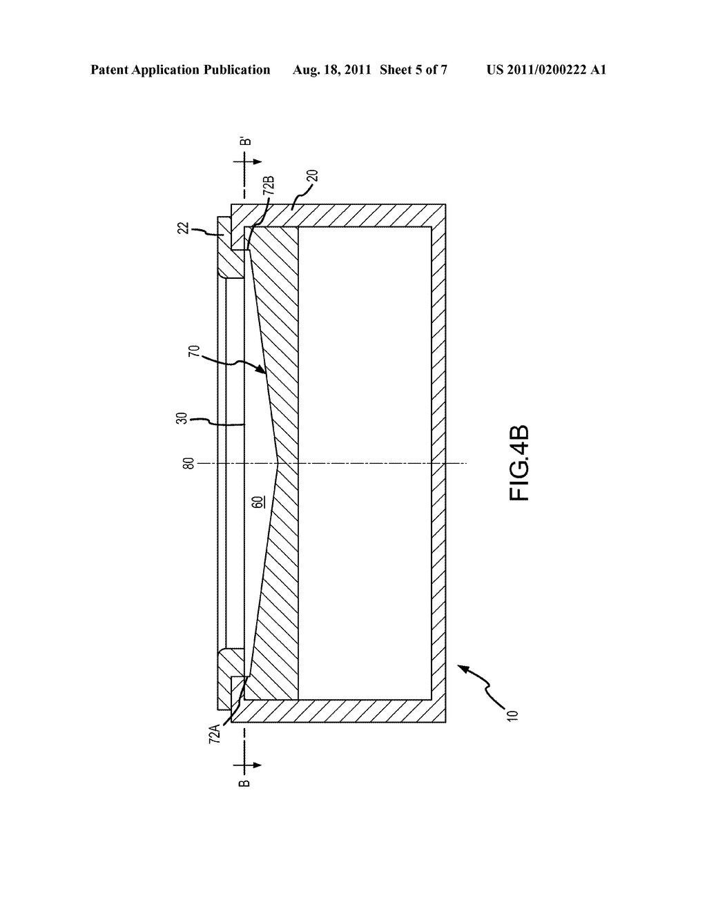 IMPLANTABLE MICROPHONE WITH SHAPED CHAMBER - diagram, schematic, and image 06