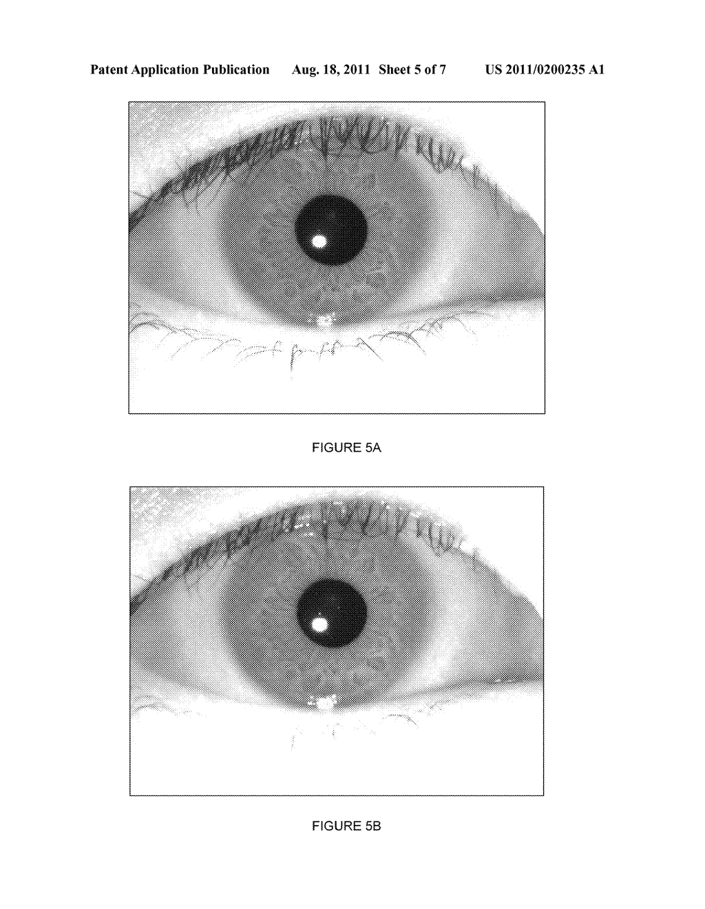 Iris Data Extraction - diagram, schematic, and image 06