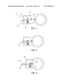 INTERVENTION METHOD AND APPARATUS diagram and image