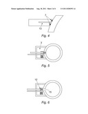 INTERVENTION METHOD AND APPARATUS diagram and image