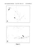 Compositions and Methods for the Treatment of Vitiligo diagram and image