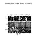 COMBINATION THERAPY OF BETA-GLYCOLIPIDS AND ANTIBODIES FOR THE TREATMENT     OF IMMUNE-RELATED DISORDERS diagram and image