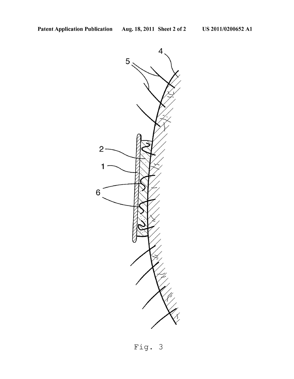 Flexible Personal Care Article - diagram, schematic, and image 03