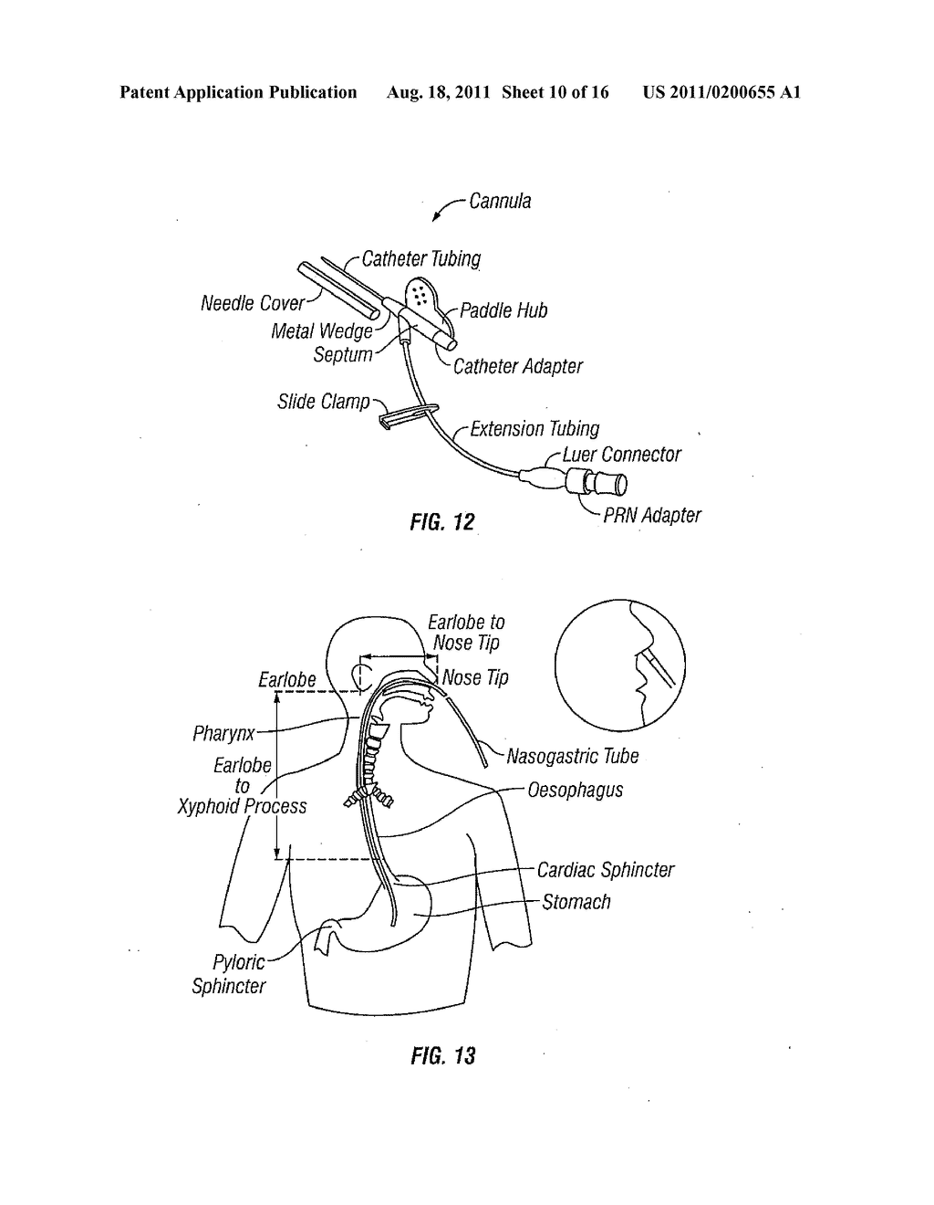 Systems and methods that kill infectious agents (bacteria) without the use     of a systemic anti-biotic - diagram, schematic, and image 11