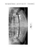 THERAPEUTIC TOOTH BUD ABLATION diagram and image