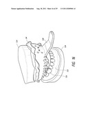 THERAPEUTIC TOOTH BUD ABLATION diagram and image