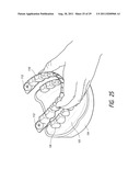 THERAPEUTIC TOOTH BUD ABLATION diagram and image