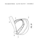 THERAPEUTIC TOOTH BUD ABLATION diagram and image