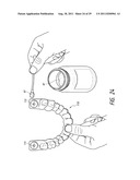 THERAPEUTIC TOOTH BUD ABLATION diagram and image