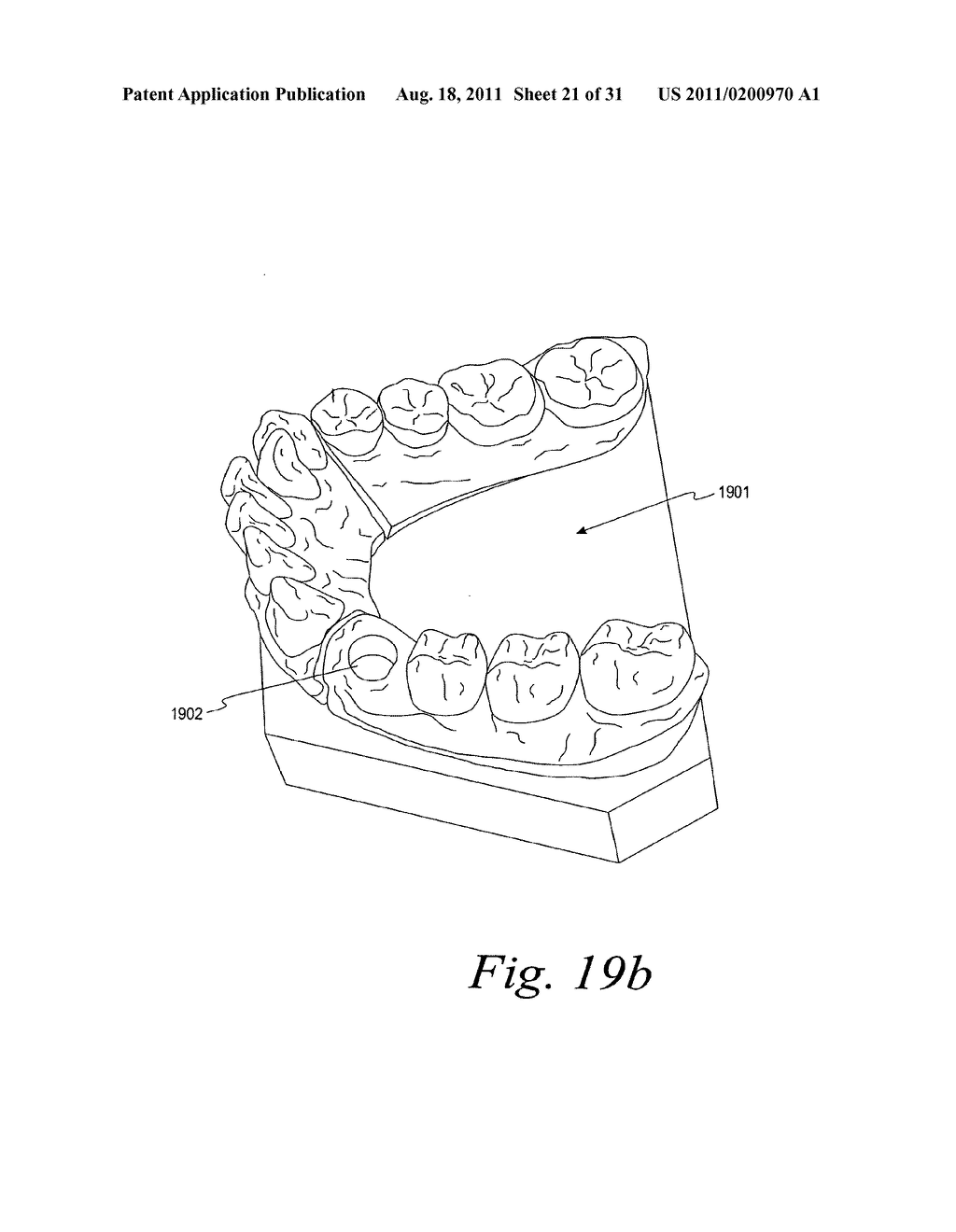 METHODS FOR PLACING AN IMPLANT ANALOG IN A PHYSICAL MODEL OF THE PATIENT'S     MOUTH - diagram, schematic, and image 22