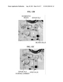 CENTRIFUGAL FORCE-BASED MICROFLUIDIC DEVICE FOR PROTEIN DETECTION AND     MICROFLUIDIC SYSTEM INCLUDING THE SAME diagram and image