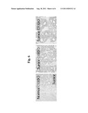 Biomarkers Indicative of Colon Cancer and Metastasis and Diagnosis and     Screening Therapeutics Using the Same diagram and image