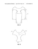 MODIFIED TRILOBE SHAPE FOR MALEIC ANHYDRIDE CATALYST diagram and image