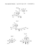 HEART HELP DEVICE, SYSTEM, AND METHOD diagram and image