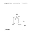 IMPLANT FOR TREATMENT OF VAGINAL AND/OR UTERINE PROLAPSE diagram and image