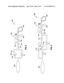 REMOTELY ADJUSTABLE GASTRIC BANDING SYSTEM diagram and image