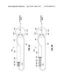 REMOTELY ADJUSTABLE GASTRIC BANDING SYSTEM diagram and image