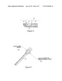 LASER GUIDED ENDOSCOPIC SURGICAL TOOL diagram and image