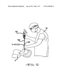 Endotracheal tube exchanger and detachable stylet assembly therefor diagram and image